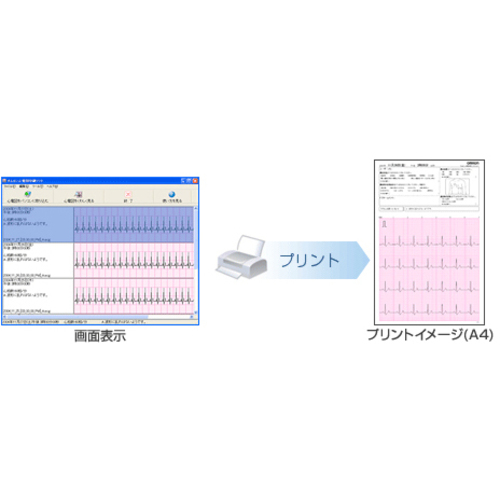 心電計　心電図印刷ソフト　ＨＣＧ－ＳＯＦＴ－２