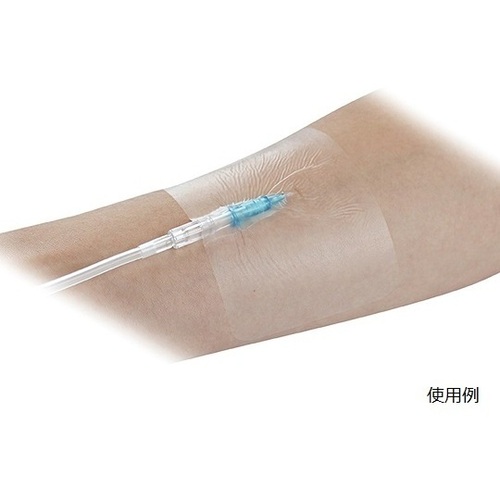 ミリオンエイド フィルフィックス20(フィルムドレッシング) 60×90mm 100枚入 YB-256090 : ミリオンエイド フィルフィックス20 60×70mm 100枚